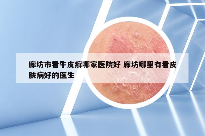 廊坊市看牛皮癣哪家医院好 廊坊哪里有看皮肤病好的医生