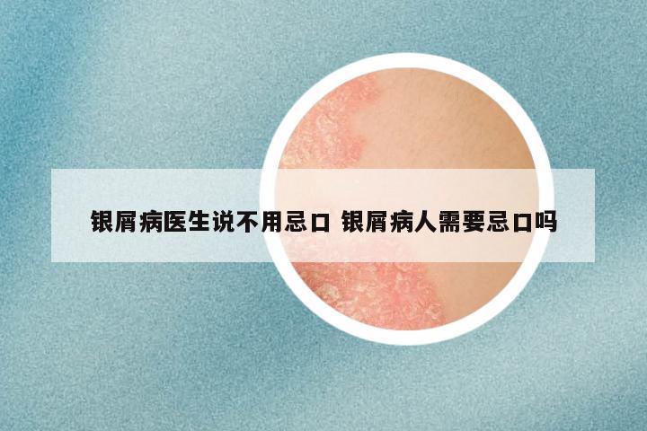 银屑病医生说不用忌口 银屑病人需要忌口吗