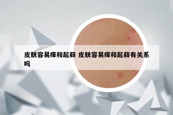 皮肤容易痒和起藓 皮肤容易痒和起藓有关系吗
