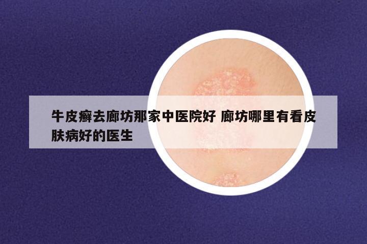 牛皮癣去廊坊那家中医院好 廊坊哪里有看皮肤病好的医生