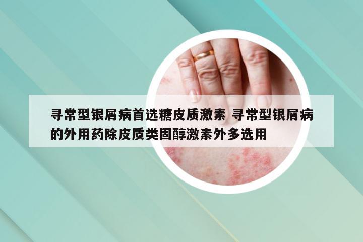 寻常型银屑病首选糖皮质激素 寻常型银屑病的外用药除皮质类固醇激素外多选用