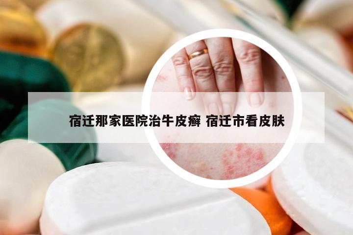 宿迁那家医院治牛皮癣 宿迁市看皮肤