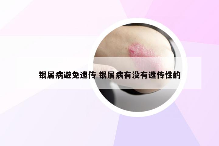 银屑病避免遗传 银屑病有没有遗传性的