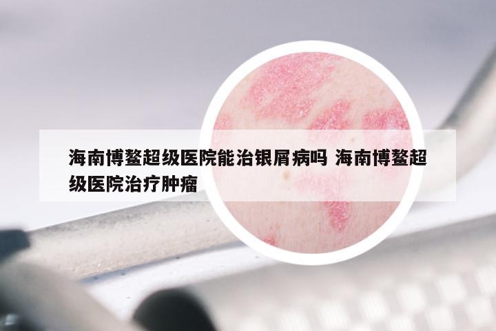 海南博鳌超级医院能治银屑病吗 海南博鳌超级医院治疗肿瘤