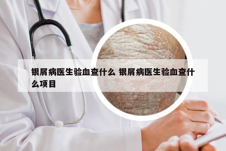 银屑病医生验血查什么 银屑病医生验血查什么项目
