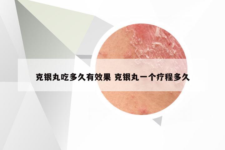 克银丸吃多久有效果 克银丸一个疗程多久