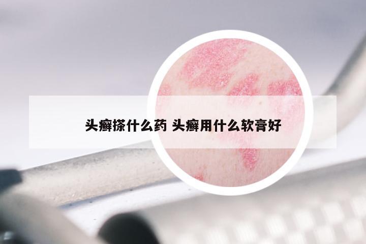 头癣搽什么药 头癣用什么软膏好