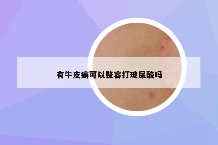 有牛皮癣可以整容打玻尿酸吗