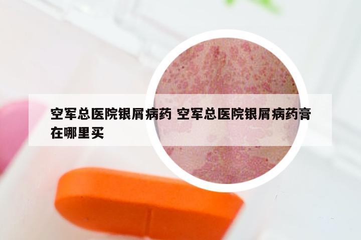 空军总医院银屑病药 空军总医院银屑病药膏在哪里买