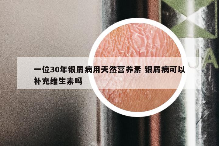 一位30年银屑病用天然营养素 银屑病可以补充维生素吗