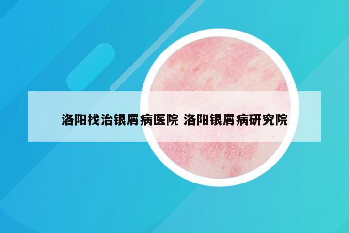 洛阳找治银屑病医院 洛阳银屑病研究院