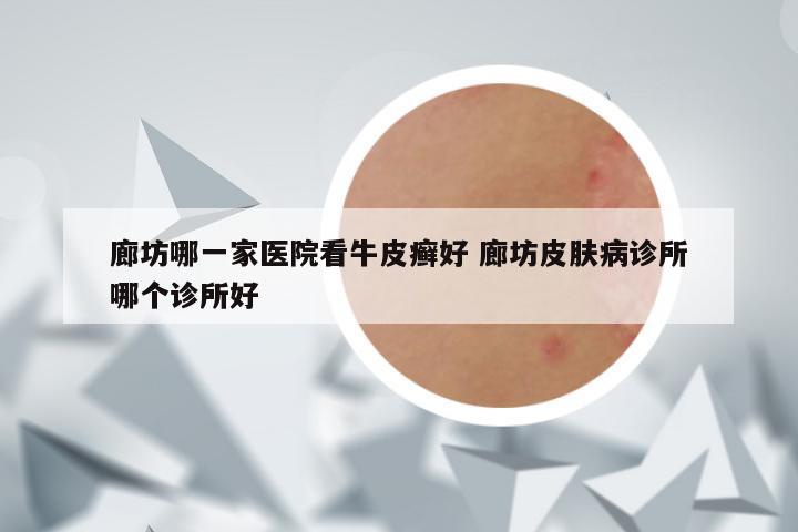 廊坊哪一家医院看牛皮癣好 廊坊皮肤病诊所哪个诊所好