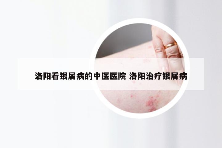 洛阳看银屑病的中医医院 洛阳治疗银屑病