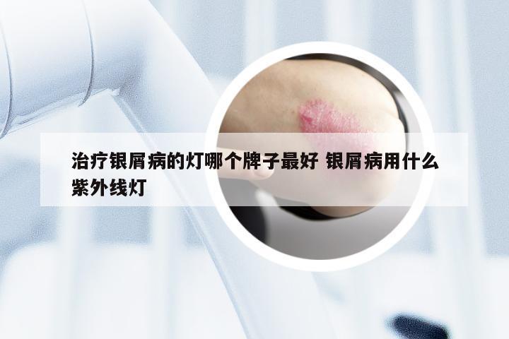 治疗银屑病的灯哪个牌子最好 银屑病用什么紫外线灯