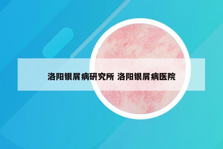 洛阳银屑病研究所 洛阳银屑病医院