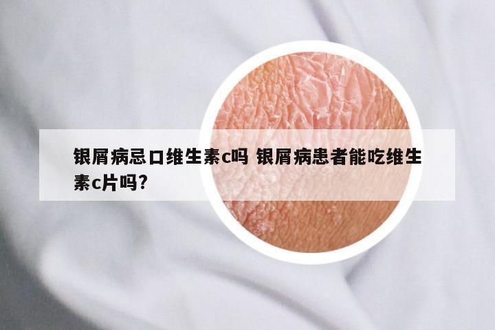 银屑病忌口维生素c吗 银屑病患者能吃维生素c片吗?