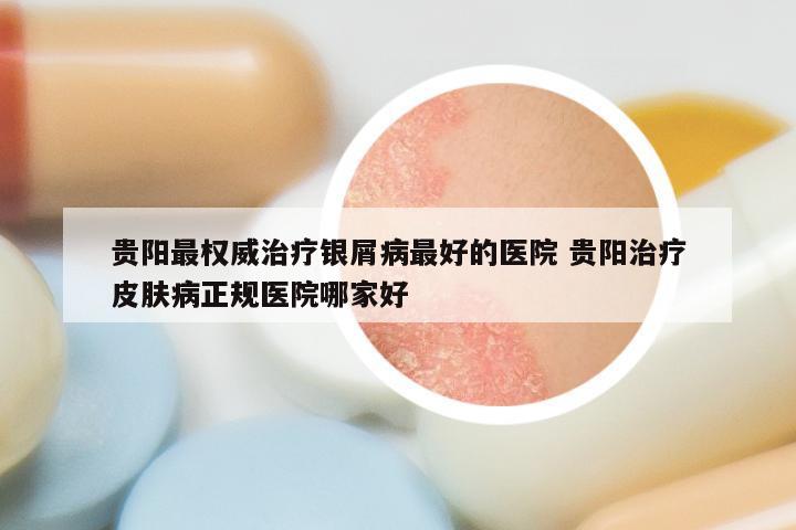 贵阳最权威治疗银屑病最好的医院 贵阳治疗皮肤病正规医院哪家好