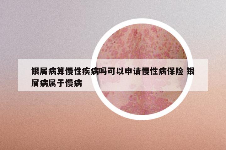 银屑病算慢性疾病吗可以申请慢性病保险 银屑病属于慢病