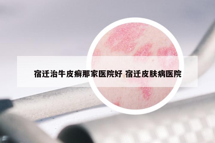 宿迁治牛皮癣那家医院好 宿迁皮肤病医院