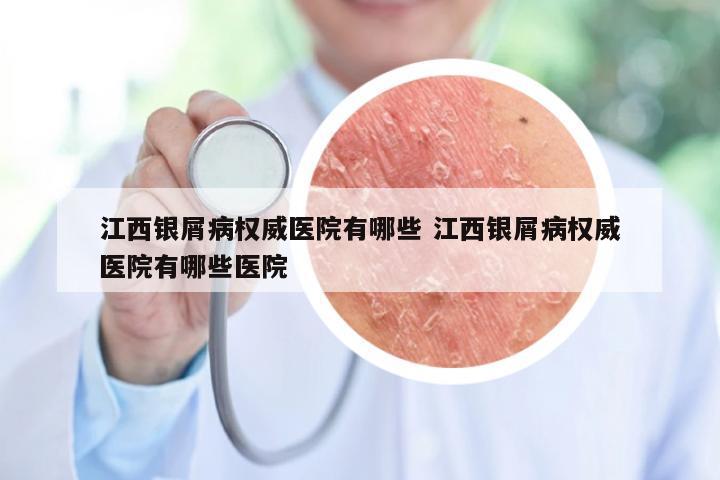 江西银屑病权威医院有哪些 江西银屑病权威医院有哪些医院