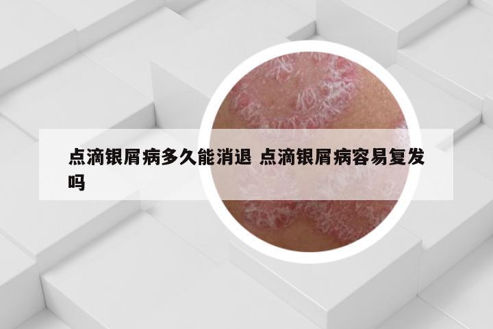 点滴银屑病多久能消退 点滴银屑病容易复发吗