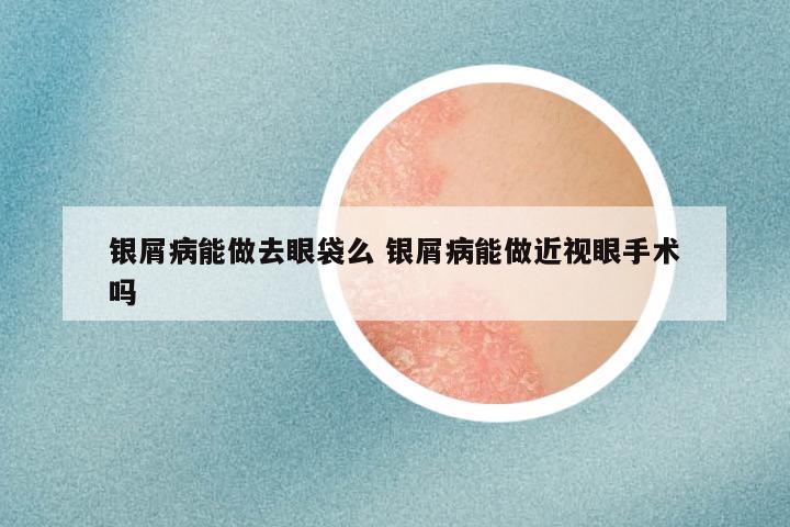银屑病能做去眼袋么 银屑病能做近视眼手术吗