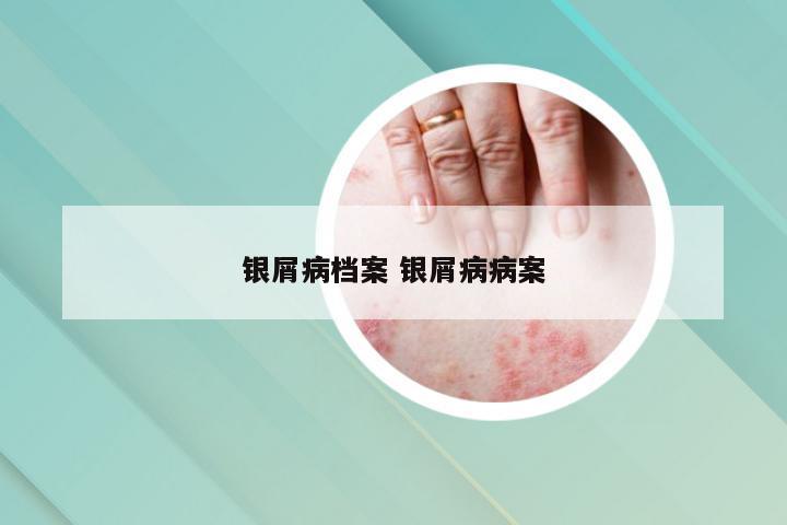 银屑病档案 银屑病病案