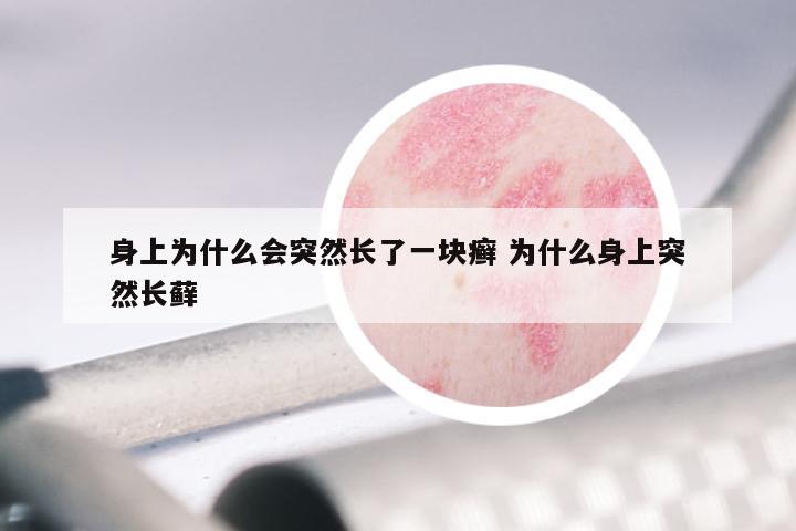 身上为什么会突然长了一块癣 为什么身上突然长藓