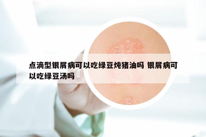 点滴型银屑病可以吃绿豆炖猪油吗 银屑病可以吃绿豆汤吗