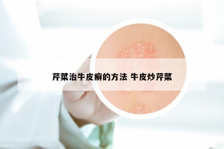 芹菜治牛皮癣的方法 牛皮炒芹菜