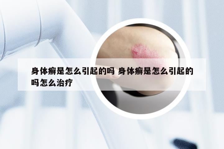 身体癣是怎么引起的吗 身体癣是怎么引起的吗怎么治疗