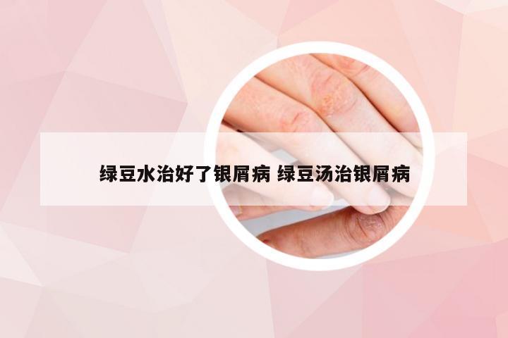 绿豆水治好了银屑病 绿豆汤治银屑病