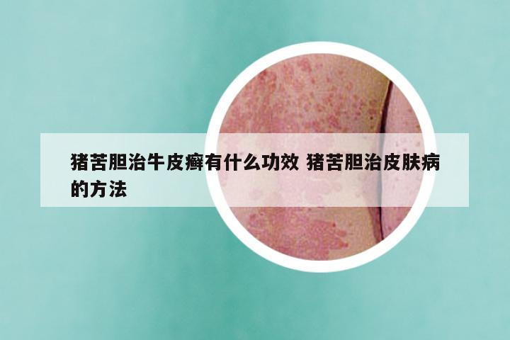 猪苦胆治牛皮癣有什么功效 猪苦胆治皮肤病的方法