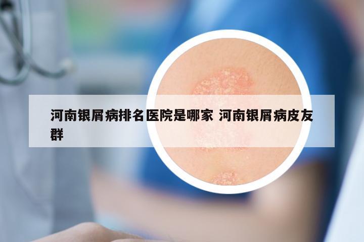 河南银屑病排名医院是哪家 河南银屑病皮友群
