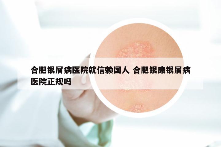 合肥银屑病医院就信赖国人 合肥银康银屑病医院正规吗