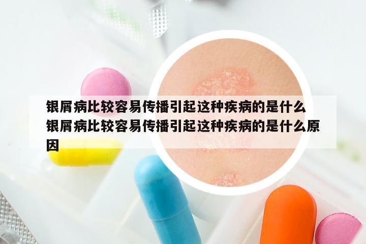 银屑病比较容易传播引起这种疾病的是什么 银屑病比较容易传播引起这种疾病的是什么原因