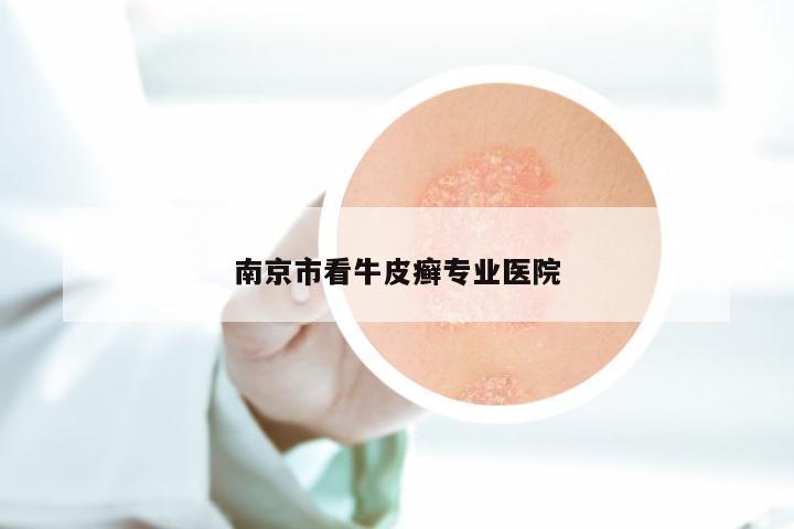 南京市看牛皮癣专业医院