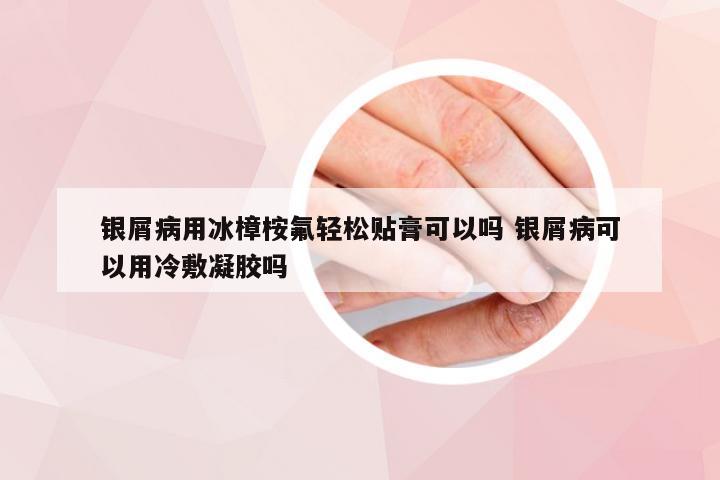 银屑病用冰樟桉氟轻松贴膏可以吗 银屑病可以用冷敷凝胶吗