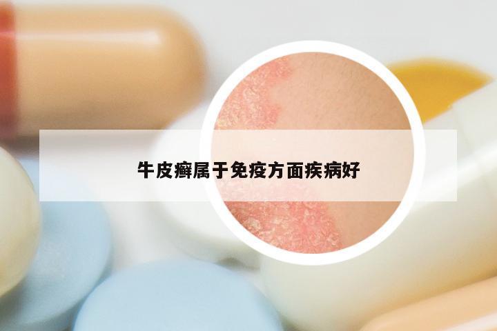 牛皮癣属于免疫方面疾病好