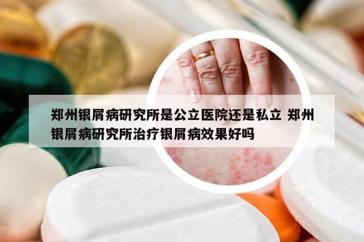 郑州银屑病研究所是公立医院还是私立 郑州银屑病研究所治疗银屑病效果好吗