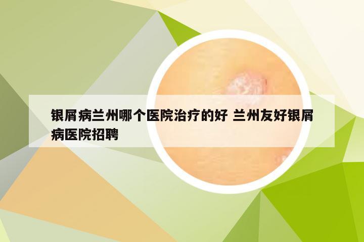 银屑病兰州哪个医院治疗的好 兰州友好银屑病医院招聘