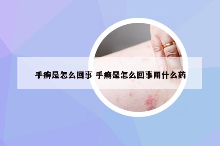 手癣是怎么回事 手癣是怎么回事用什么药