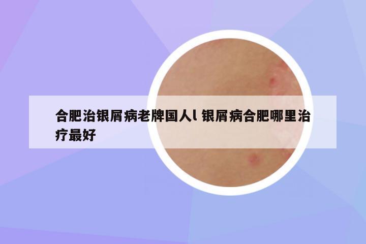 合肥治银屑病老牌国人l 银屑病合肥哪里治疗最好