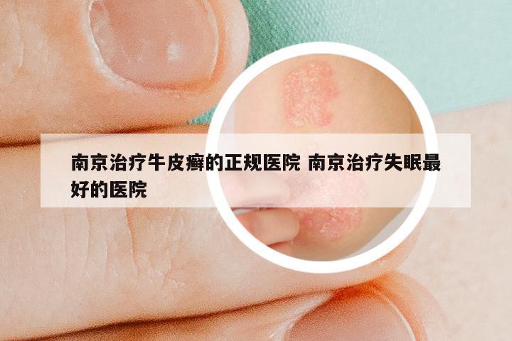 南京治疗牛皮癣的正规医院 南京治疗失眠最好的医院