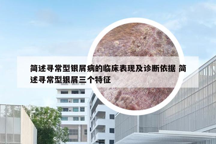 简述寻常型银屑病的临床表现及诊断依据 简述寻常型银屑三个特征