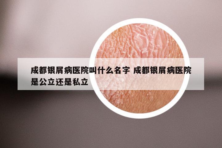 成都银屑病医院叫什么名字 成都银屑病医院是公立还是私立