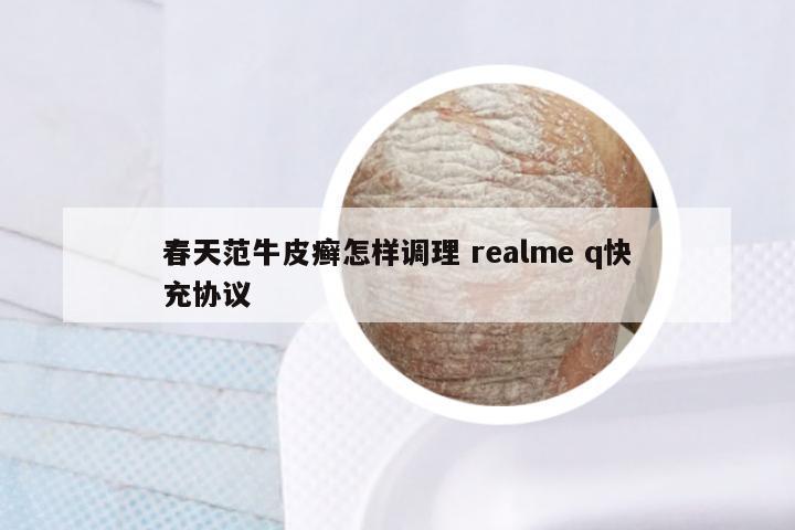 春天范牛皮癣怎样调理 realme q快充协议