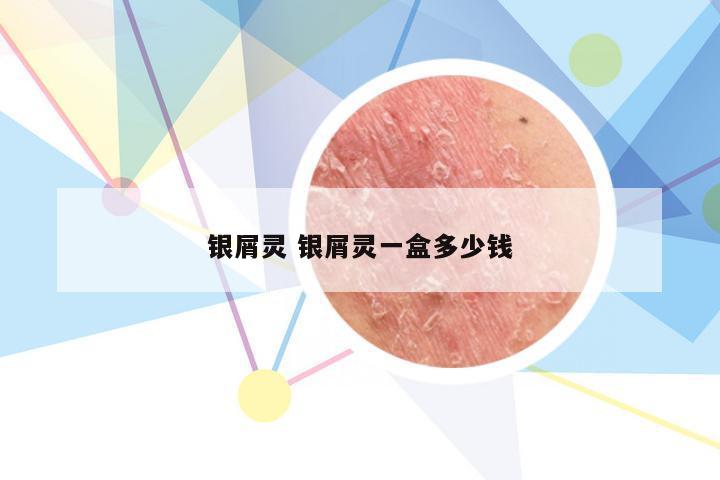 银屑灵 银屑灵一盒多少钱