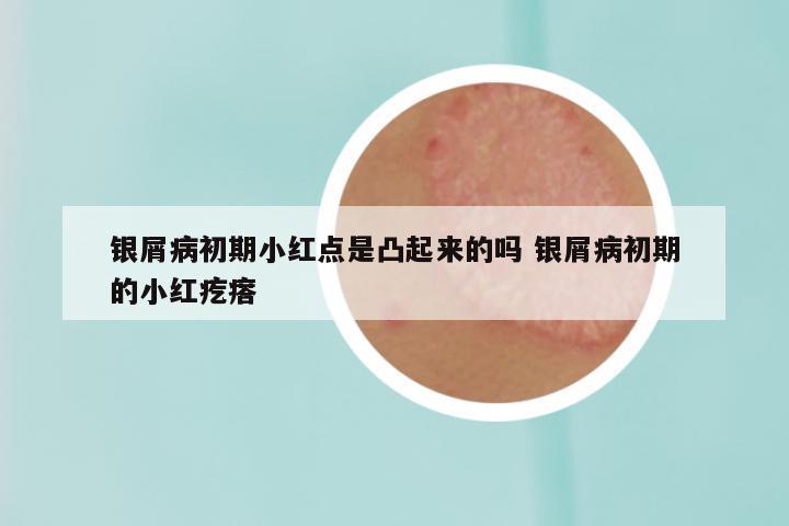 银屑病初期小红点是凸起来的吗 银屑病初期的小红疙瘩