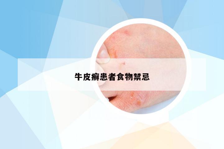 牛皮癣患者食物禁忌